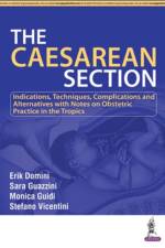 The Caesarean Section af Erik Domini