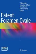 Patent Foramen Ovale