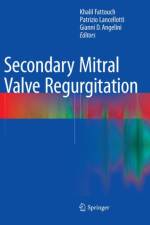 Secondary Mitral Valve Regurgitation