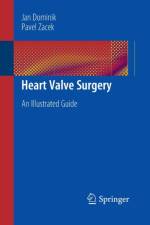 Heart Valve Surgery af Jan Dominik