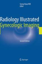 Radiology Illustrated: Gynecologic Imaging