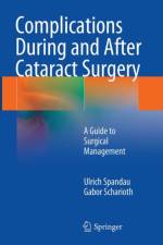 Complications During and After Cataract Surgery af Ulrich Spandau