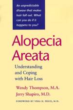 Alopecia Areata af Wendy (New Westminster Healt Dept.) Thompson