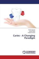 Caries - A Changing Paradigm af Agarwal Richa