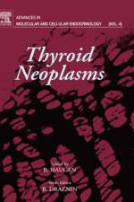 Thyroid Neoplasms af Boris Draznin