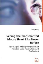 Seeing the Transplanted Mouse Heart Like Never Before af Ramy Bishay