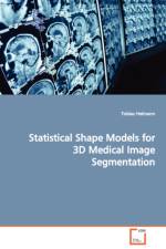 Statistical Shape Models for 3D Medical Image Segmentation af Tobias Heimann