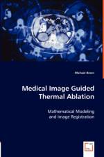 Medical Image Guided Thermal Ablation af Professor Michael (Reed College Breen