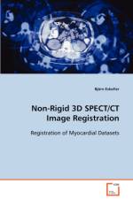 Non-Rigid 3D SPECT/CT Image Registration af Bjoern Eskofier