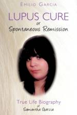 Lupus Cure or Spontaneous Remission af Emilio Garcia