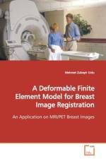 A Deformable Finite Element Model for Breast Image Registration af Mehmet Zubeyir Unlu