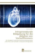 Intraprozedurale Bildgebung fur die Ablation von Vorhofflimmern af Sotirios Nedios