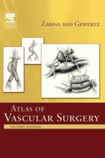 Atlas Of Vascular Surgery - Paperback Edition af Christopher K. (Walter Clifford and Elsa Rooney Chidester Professorship in Surgery Zarins