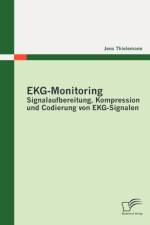 EKG-Monitoring af Jens Thielemann
