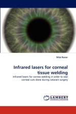 Infrared Lasers for Corneal Tissue Welding af Rfat Rasier