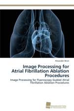 Image Processing for Atrial Fibrillation Ablation Procedures af Alexander Brost
