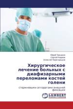 Khirurgicheskoe Lechenie Bol'nykh S Diafizarnymi Perelomami Kostey Goleni af Troshkin Yuriy