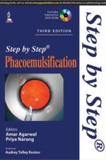 Step by Step Phacoemulsification