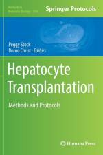 Hepatocyte Transplantation