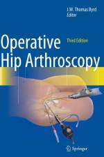 Operative Hip Arthroscopy