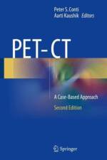 PET-CT