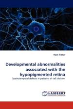 Developmental abnormalities associated with the hypopigmented retina af Marc Tibber