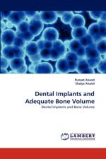 Dental Implants and Adequate Bone Volume af Dr Shalya Anand