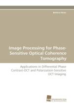 Image Processing for Phase-Sensitive Optical Coherence Tomography af Bettina Heise