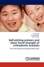 Self-etching primers and shear bond strength of orthodontic brackets af Amit (Oak Ridge National Laboratory) Goyal