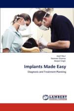 Implants Made Easy af Harpal Singh