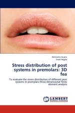 Stress distribution of post systems in premolars af Abhilasha Gupta