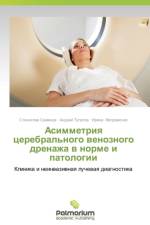 Asimmetriya Tserebral'nogo Venoznogo Drenazha V Norme I Patologii af Semenov Stanislav