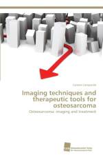 Imaging techniques and therapeutic tools for osteosarcoma af Carmen Campanile