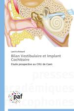 Bilan Vestibulaire Et Implant Cochleaire af Robard-L
