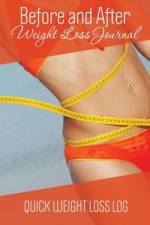 Before and After Weight Loss Journal af Speedy Publishing LLC