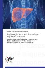 Radiologie Interventionnelle Et Hepatocarcinome af Collectif