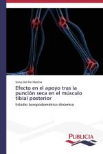 Efecto en el apoyo tras la puncion seca en el musculo tibial posterior af del Rio Medina Sonia