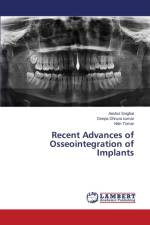 Recent Advances of Osseointegration of Implants af Singhal Anshul