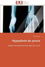 Hypoplasie du pouce af Gasnier-P