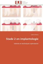 Stade 2 en implantologie af Ohana-G