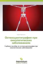 Osteostsintigrafiya Pri Onkologicheskikh Zabolevaniyakh af Vartanyan Karen