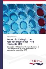 Protocolo biologico de reconocimiento del TNFα mediante SPR af Patricia Ansorena