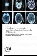 L'Etude Des Connectivites Fonctionnelles Dans La Maladie d'Alzheimer af Maiz-S