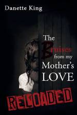 Bruises from my Mother's Love