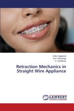 Retraction Mechanics in Straight Wire Appliance af Jyothikiran H