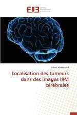 Localisation Des Tumeurs Dans Des Images Irm C r brales af Abdessayed-A