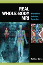 Real Whole-Body MRI: Requirements, Indications, Perspectives af Mathias Goyen