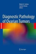 Diagnostic Pathology of Ovarian Tumors