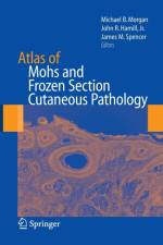 Atlas of Mohs and Frozen Section Cutaneous Pathology