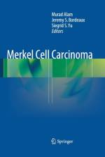 Merkel Cell Carcinoma